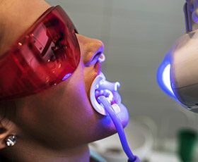Woman receiving Zoom! teeth whitening