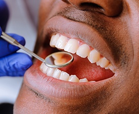 Closeup of patient during dental treatment