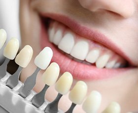 Closeup of a smile with shade guide held up to it