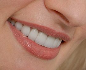 Closeup of healthy smile