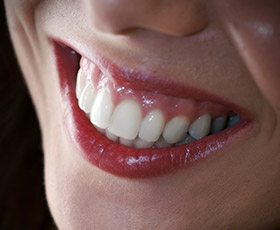 Closeup of healthy teeth and gums