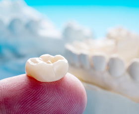 Closeup of dental crown on patient's finger