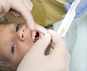 Child receiving fluoride treatment