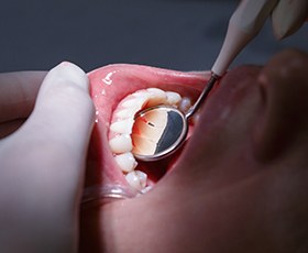 Patient receiving dental exam