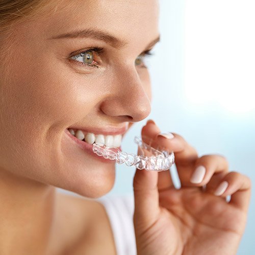 Woman placing Invisalign tray