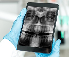 Digital x-rays on tablet computer