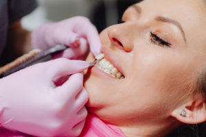 Dentist placing Lumineer on woman’s tooth