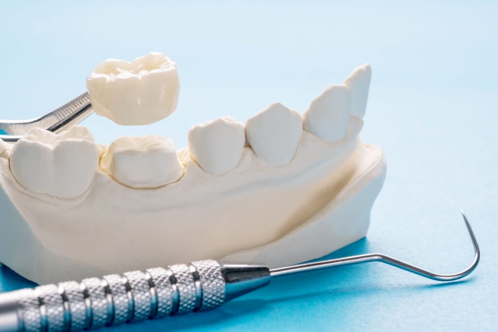 Closeup of dental crown being lifted from model tooth